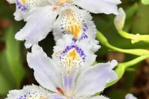 体のむくみ、実は怖いことも‥
